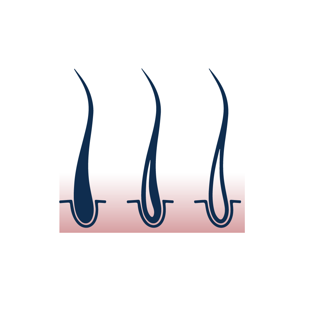 Chute De Cheveux